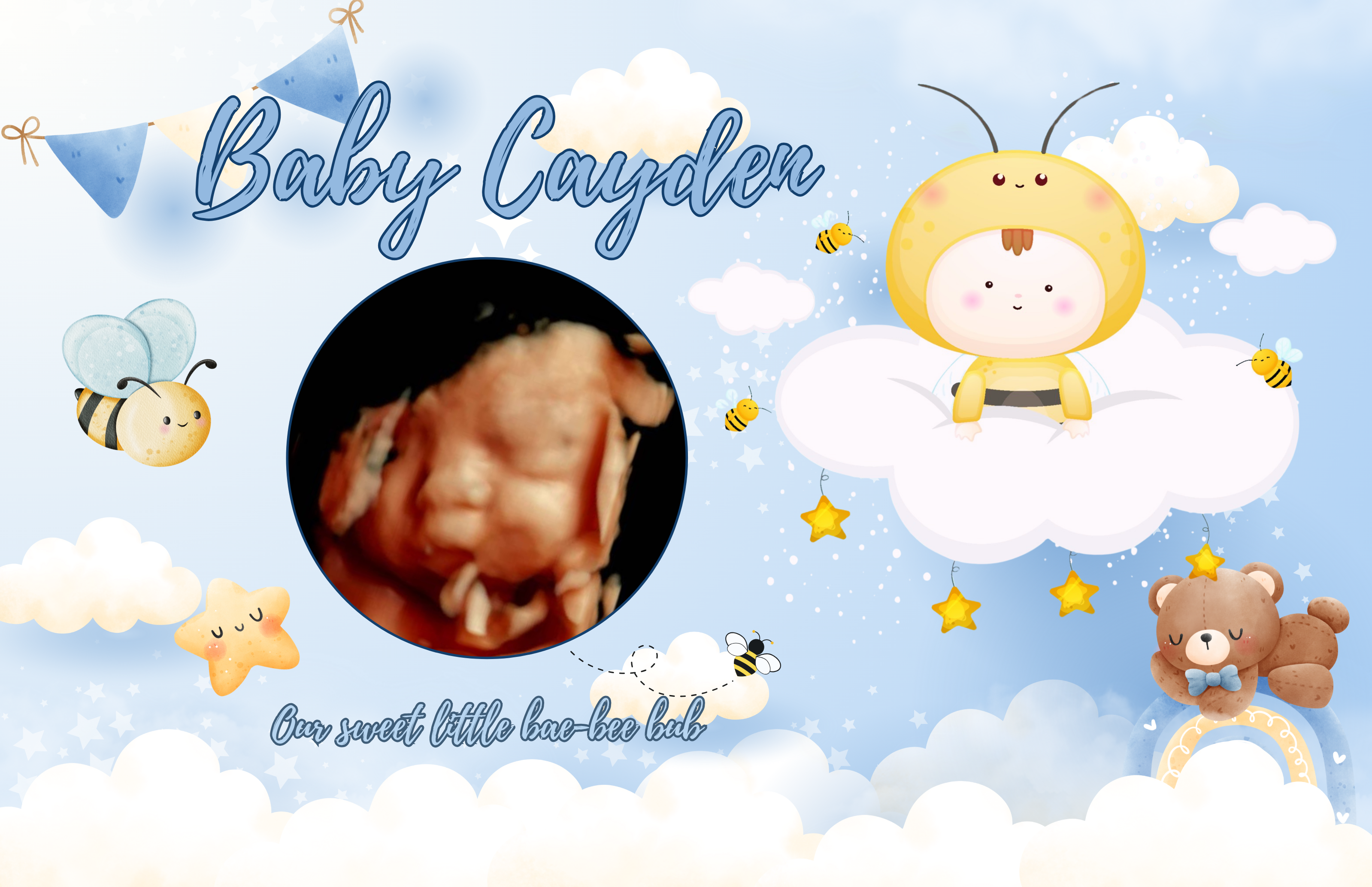 Cayden's ultrasound